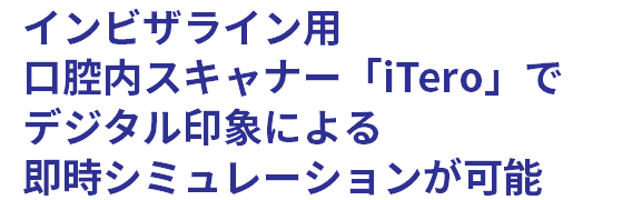 インビザライン用 口腔内スキャナー「iTero」で デジタル印象による 即時シミュレーションが可能